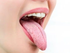 Кандидоз полости рта - причины, симптомы, лечение и профилактика